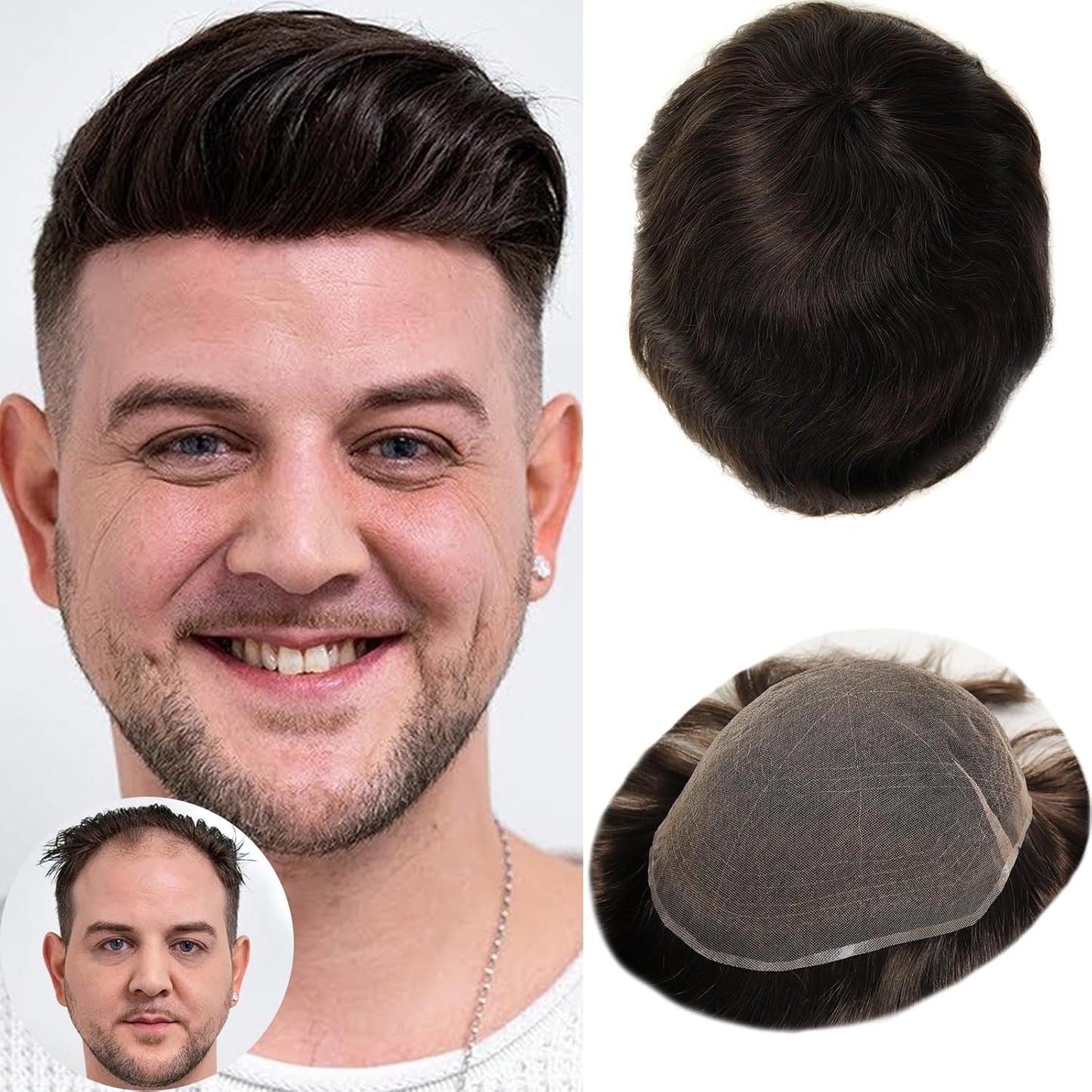 Real Skinlike HD Lace Toupee Hair for Men | 8x10 Inch Ultra Lace Base Hairpieces